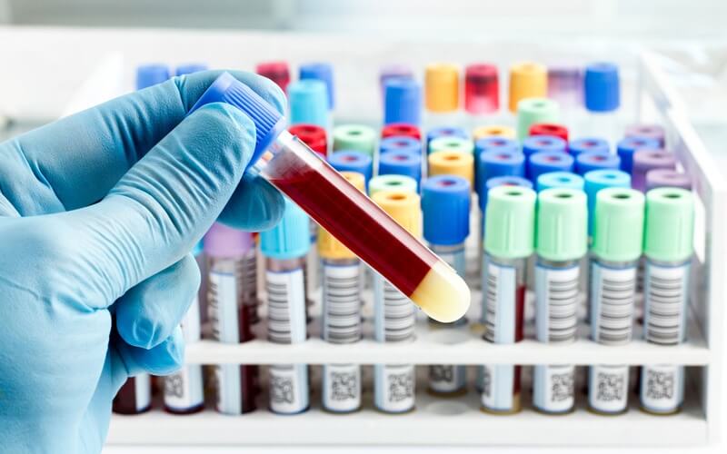 Diagnostics Sheep Services